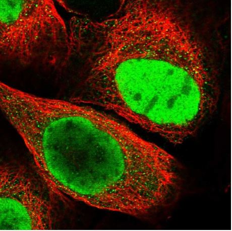 Immunocytochemistry/ Immunofluorescence - Anti-HRP2 antibody (AB184988)