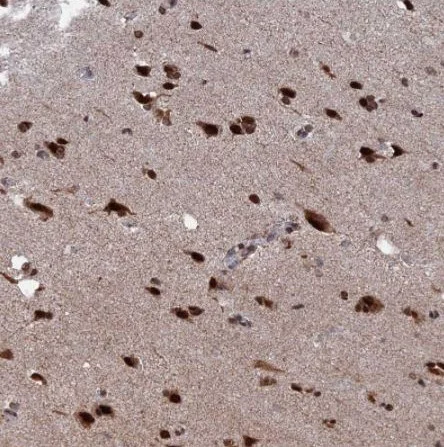 Immunohistochemistry (Formalin/PFA-fixed paraffin-embedded sections) - Anti-HRP2 antibody (AB184988)