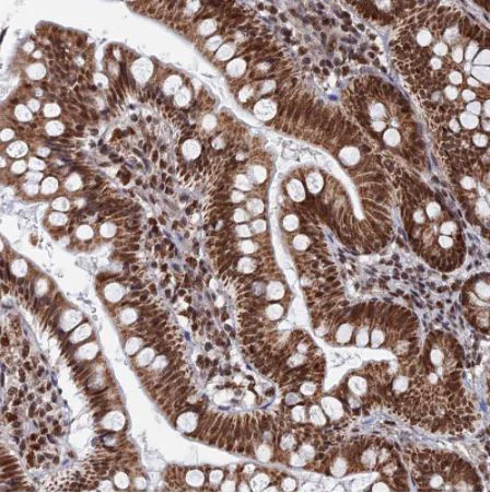 Immunohistochemistry (Formalin/PFA-fixed paraffin-embedded sections) - Anti-HRP2 antibody (AB184988)