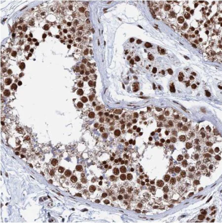 Immunohistochemistry (Formalin/PFA-fixed paraffin-embedded sections) - Anti-HRP2 antibody (AB184988)
