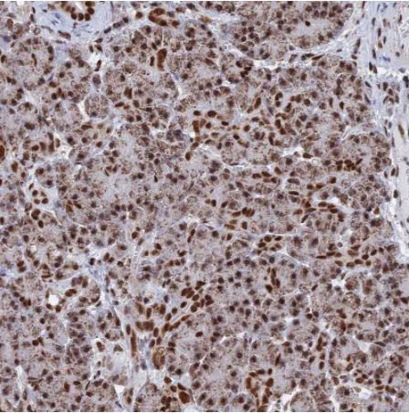 Immunohistochemistry (Formalin/PFA-fixed paraffin-embedded sections) - Anti-HRP2 antibody (AB184988)