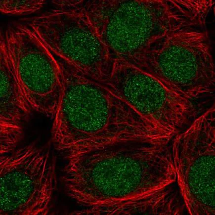 Immunocytochemistry/ Immunofluorescence - Anti-HRPT2/Parafibromin antibody (AB220097)