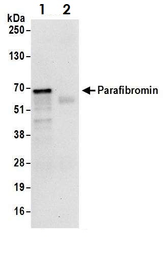 Immunoprecipitation - Anti-HRPT2/Parafibromin antibody (AB70533)