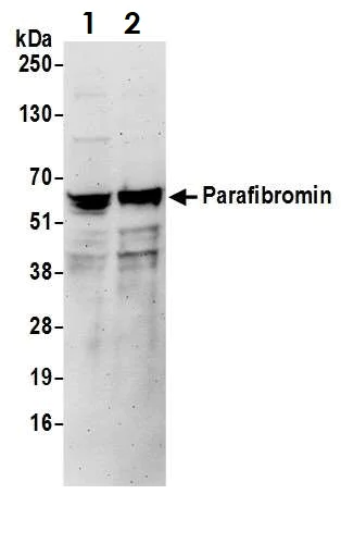Western blot - Anti-HRPT2/Parafibromin antibody (AB70533)