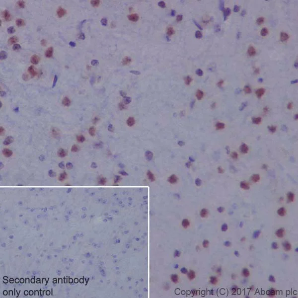 Immunohistochemistry (Formalin/PFA-fixed paraffin-embedded sections) - Anti-HRPT2/Parafibromin antibody [EPR19927] (AB223840)