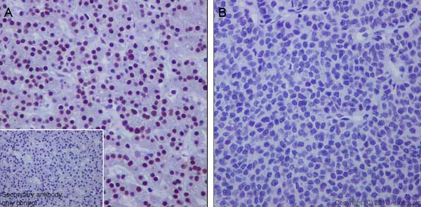 Immunohistochemistry (Formalin/PFA-fixed paraffin-embedded sections) - Anti-HRPT2/Parafibromin antibody [EPR19927] (AB223840)