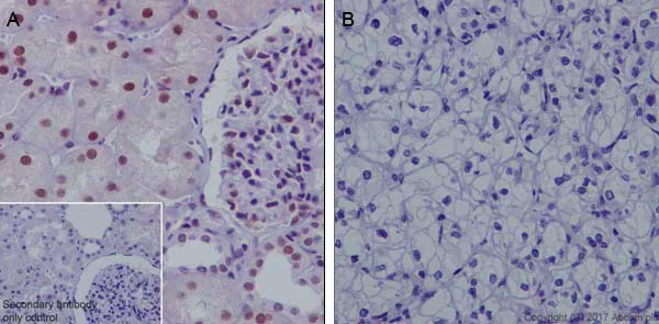 Immunohistochemistry (Formalin/PFA-fixed paraffin-embedded sections) - Anti-HRPT2/Parafibromin antibody [EPR19927] (AB223840)