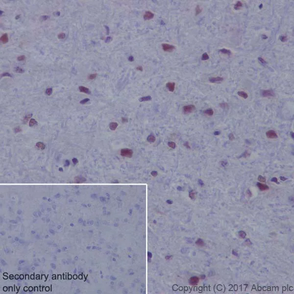 Immunohistochemistry (Formalin/PFA-fixed paraffin-embedded sections) - Anti-HRPT2/Parafibromin antibody [EPR19927] (AB223840)