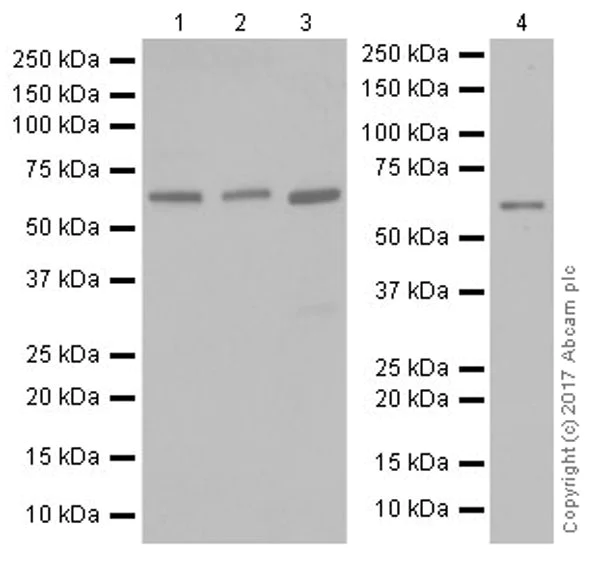 Western blot - Anti-HRPT2/Parafibromin antibody [EPR19927] (AB223840)