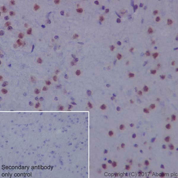 Immunohistochemistry (Formalin/PFA-fixed paraffin-embedded sections) - Anti-HRPT2/Parafibromin antibody [EPR19927] - BSA and Azide free (AB251575)