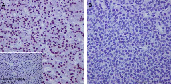 Immunohistochemistry (Formalin/PFA-fixed paraffin-embedded sections) - Anti-HRPT2/Parafibromin antibody [EPR19927] - BSA and Azide free (AB251575)