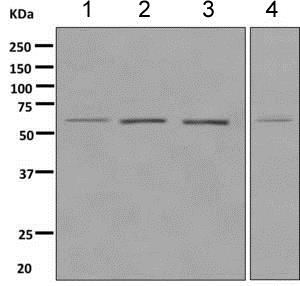 Western blot - Anti-HRPT2/Parafibromin antibody [EPR9218] (AB139189)