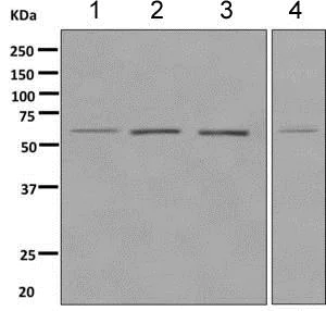 Western blot - Anti-HRPT2/Parafibromin antibody [EPR9218] (AB139189)
