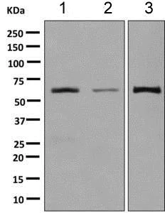 Western blot - Anti-HRPT2/Parafibromin antibody [EPR9219] (AB139187)