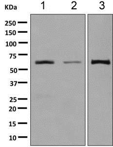 Western blot - Anti-HRPT2/Parafibromin antibody [EPR9219] - BSA and Azide free (AB248868), expandable thumbnail