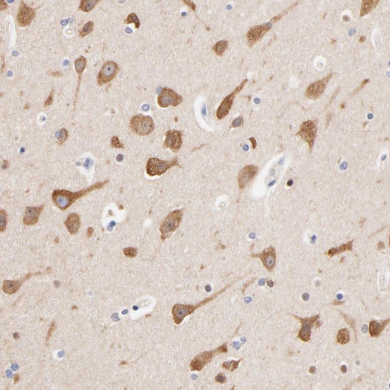 Immunohistochemistry (Formalin/PFA-fixed paraffin-embedded sections) - Anti-HS3ST1 antibody (AB254718)
