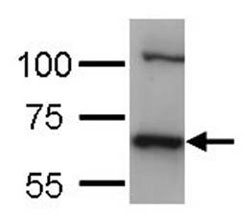 Western blot - Anti-Hsc70 antibody (AB137808), expandable thumbnail