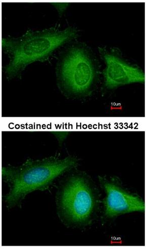 Immunocytochemistry/ Immunofluorescence - Anti-Hsc70 antibody (AB154415), expandable thumbnail