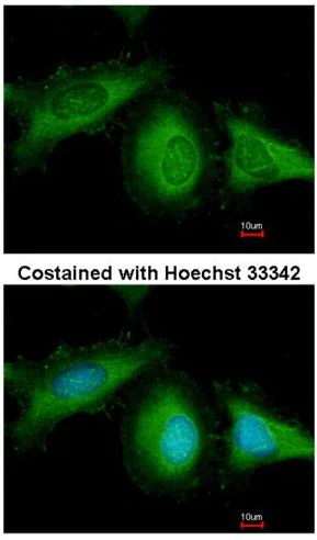 Immunocytochemistry/ Immunofluorescence - Anti-Hsc70 antibody (AB154415)
