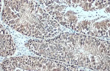 Immunohistochemistry (Formalin/PFA-fixed paraffin-embedded sections) - Anti-Hsc70 antibody (AB154415)