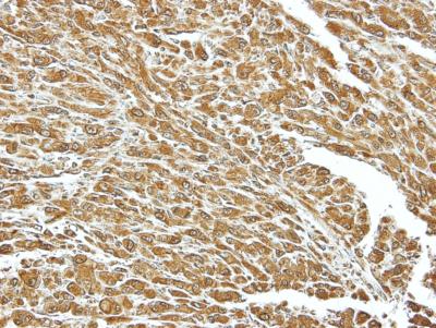 Immunohistochemistry (Formalin/PFA-fixed paraffin-embedded sections) - Anti-Hsc70 antibody (AB154415), expandable thumbnail