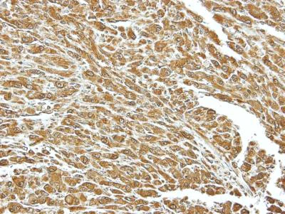 Immunohistochemistry (Formalin/PFA-fixed paraffin-embedded sections) - Anti-Hsc70 antibody (AB154415)