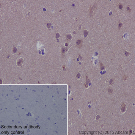 Immunohistochemistry (Formalin/PFA-fixed paraffin-embedded sections) - Anti-Hsc70 antibody [EP1531Y] (ab51052), expandable thumbnail