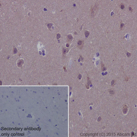 Immunohistochemistry (Formalin/PFA-fixed paraffin-embedded sections) - Anti-Hsc70 antibody [EP1531Y] (AB51052)