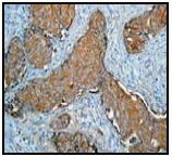 Immunohistochemistry (Formalin/PFA-fixed paraffin-embedded sections) - Anti-Hsc70 antibody [EP1531Y] - BSA and Azide free (AB220821)