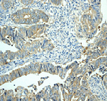 Immunohistochemistry (Formalin/PFA-fixed paraffin-embedded sections) - Anti-HSC70 Interacting Protein HIP antibody [EP3264] (AB76005), expandable thumbnail