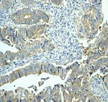 Immunohistochemistry (Formalin/PFA-fixed paraffin-embedded sections) - Anti-HSC70 Interacting Protein HIP antibody [EP3264] (AB76005)