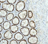 Immunohistochemistry (Formalin/PFA-fixed paraffin-embedded sections) - Anti-HSC70 Interacting Protein HIP antibody [EP3264] (AB76005)
