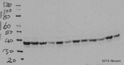 Western blot - Anti-HSD11B1 antibody (AB39364), expandable thumbnail