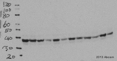 Western blot - Anti-HSD11B1 antibody (AB39364)