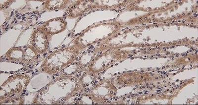 Immunohistochemistry (Formalin/PFA-fixed paraffin-embedded sections) - Anti-HSD11B2 antibody (AB203132)
