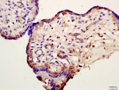 Immunohistochemistry (Formalin/PFA-fixed paraffin-embedded sections) - Anti-HSD11B2 antibody (AB203132), expandable thumbnail