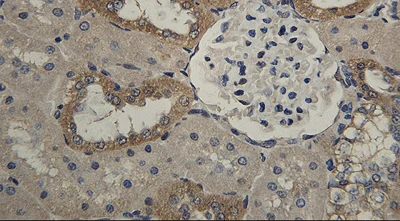 Immunohistochemistry (Formalin/PFA-fixed paraffin-embedded sections) - Anti-HSD11B2 antibody (AB203132)