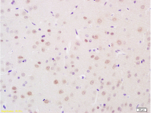 Immunohistochemistry (Formalin/PFA-fixed paraffin-embedded sections) - Anti-HSD11B2 antibody (AB203132), expandable thumbnail
