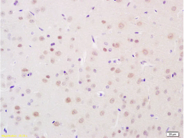 Immunohistochemistry (Formalin/PFA-fixed paraffin-embedded sections) - Anti-HSD11B2 antibody (AB203132)