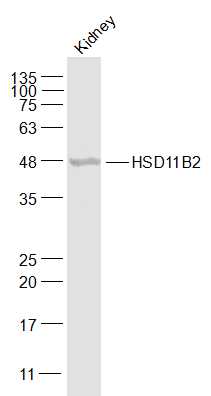 Western blot - Anti-HSD11B2 antibody (AB203132), expandable thumbnail