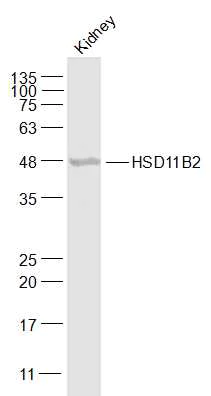 Western blot - Anti-HSD11B2 antibody (AB203132)