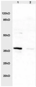 Western blot - Anti-HSD17B1 antibody (AB217851)