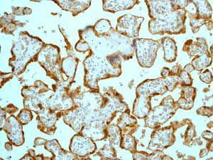 Immunohistochemistry (Formalin/PFA-fixed paraffin-embedded sections) - Anti-HSD17B1 antibody [EP1681Y] - BSA and Azide free (AB248715), expandable thumbnail