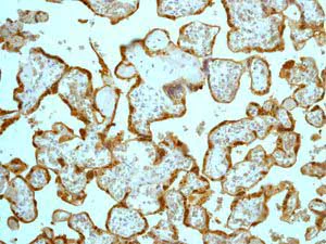 Immunohistochemistry (Formalin/PFA-fixed paraffin-embedded sections) - Anti-HSD17B1 antibody [EP1681Y] - BSA and Azide free (AB248715)