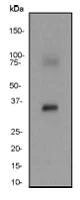 Western blot - Anti-HSD17B1 antibody [EP1681Y] - BSA and Azide free (AB248715)