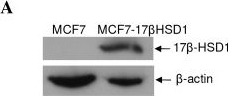 Western blot - Anti-HSD17B1 antibody [EP1682Y] (AB51045), expandable thumbnail