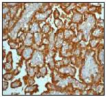 Immunohistochemistry (Formalin/PFA-fixed paraffin-embedded sections) - Anti-HSD17B1 antibody [EP1682Y] - BSA and Azide free (AB247308)