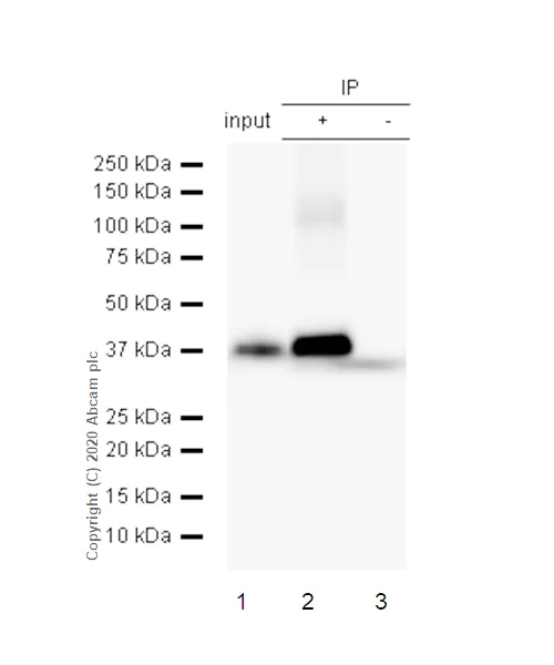 Immunoprecipitation - Anti-HSD17B1 antibody [EP1682Y] - BSA and Azide free (AB247308)