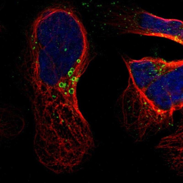 Immunocytochemistry/ Immunofluorescence - Anti-Hsd17b11 antibody (AB224437), expandable thumbnail