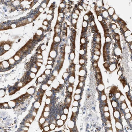 Immunohistochemistry (Formalin/PFA-fixed paraffin-embedded sections) - Anti-Hsd17b11 antibody (AB224437)